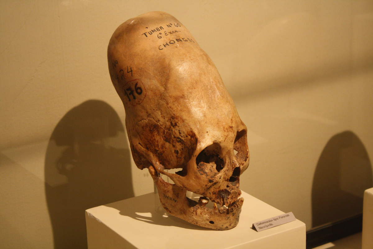 秘鲁的颅骨变形和松果体. 如何感知其他现实