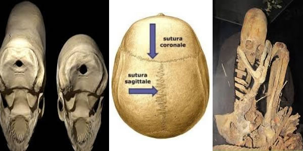 foramen-Deformation-Schädel